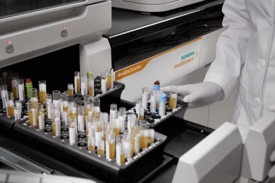 Koronavirüse Karşı Bağışıklık Ölçen Test