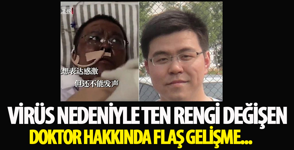Korona virüs nedeniyle ten rengi değişen doktor hakkında flaş gelişme