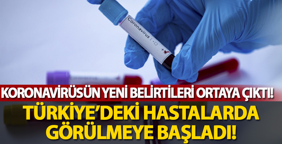 Koronavirüsün yeni belirtileri ortaya çıktı! Türkiye'deki hastalarda görülüyor!