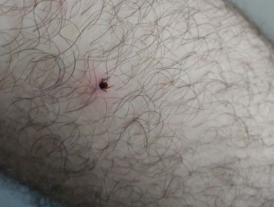 Ordu'da Kene Vakası