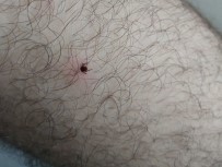 Ordu'da Kene Vakası