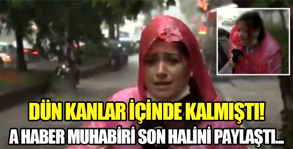 Dün kanlar içinde kalan A Haber muhabiri son halini paylaştı