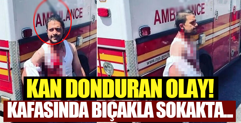 Kanlar içerisinde kaldı! Kafasında bıçakla sokak ortasında...