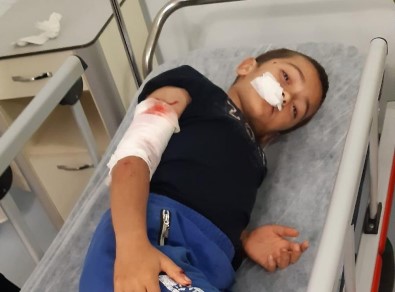 Sultangazi'de 10 Yaşındaki Çocuğa Köpek Saldırdı