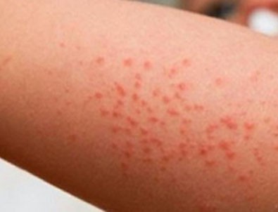 Aileler dikkat! En çok çocukları etkiliyor