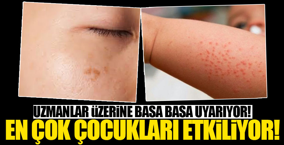 Aileler dikkat! En çok çocukları etkiliyor