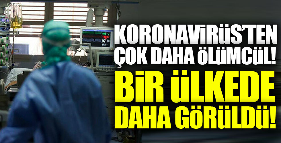 Koronavirüs'ten çok daha ölümcül! Bir ülkede daha görüldü!