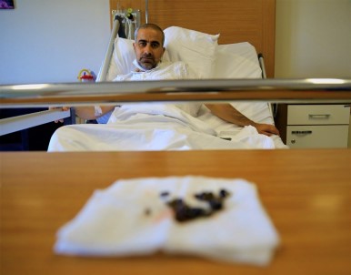 15 Yıldır Taşıdığı Böbrek Taşlarından 2 Saatlik Operasyonla Kurtuldu