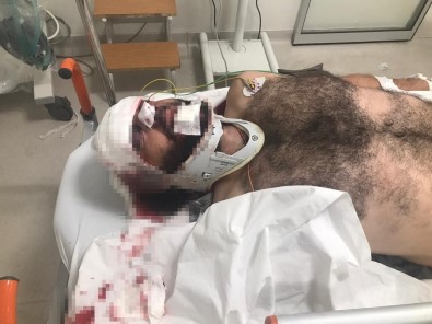 5. Kattan Düşen İşçinin Yardımına Genç Hemşire Adayı Koştu