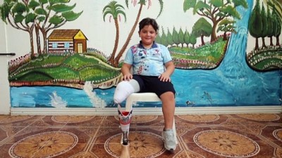 Protez Bacağına Santos Arması İşleyen Suriyeli Hamis'e Teşekkür Mesajı