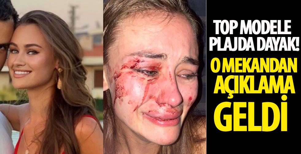 Top model Daria Kyryliuk'e plajda dayak! O mekandan açıklama geldi