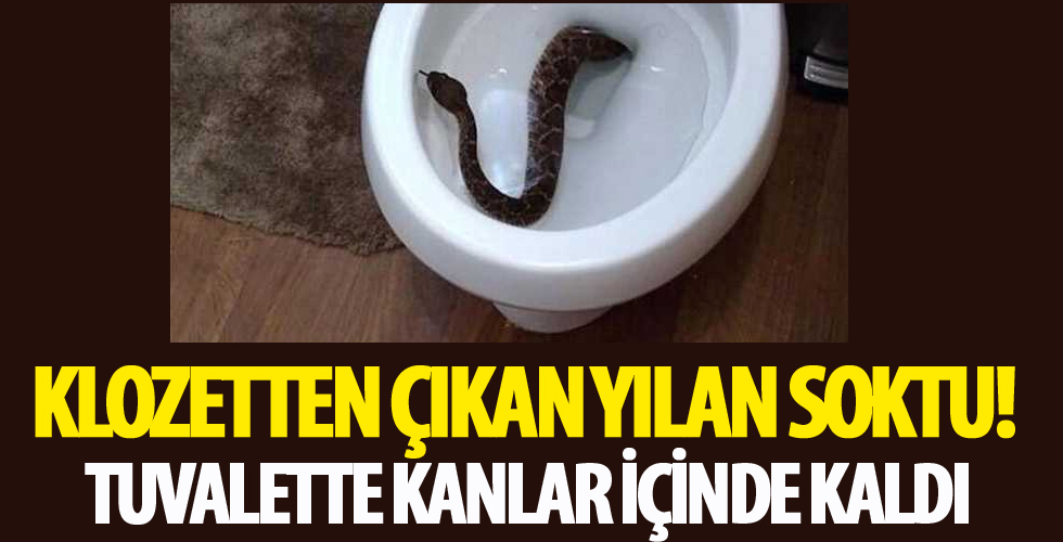 Klozetten çıkan yılan soktu! Tuvalette kanlar içinde kaldı