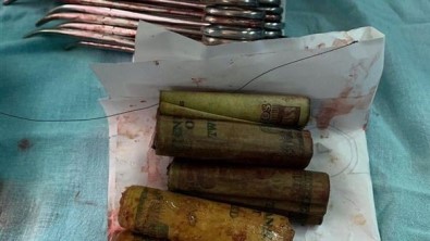 Mısır'da Bir Kişinin Midesinden 6 Bin 500 Mısır Lirası Çıktı