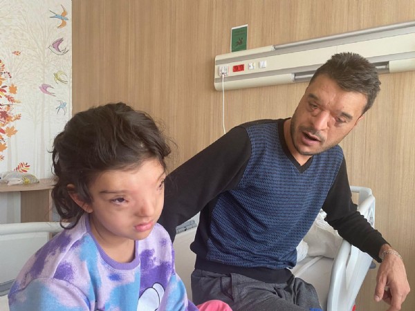 Dünyada sadece 4 ailede görüldü: 3 santime kadar indirildi