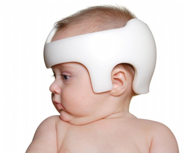 Çin'deki en son çılgınlık: Bebeklerine aylarca bu kaskı takıyorlar