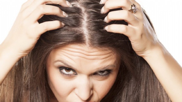 Saçkıran Nedir? Saçkıran Belirtileri Nelerdir? Saçkıran Tedavisi Nasıl Yapılır?