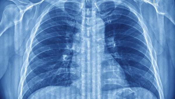 Nefes Darlığı Nasıl Geçer? Nefes Darlığına Ne İyi Gelir?