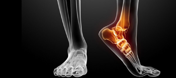 Ayak Ağrısı Nasıl Geçer? Ayak Ağrısı Neden Olur?