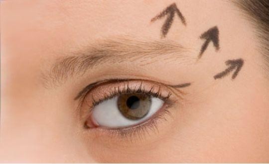 Göz Kapağı düşüklüğü Neden Olur? Göz Kapağı Düşüklüğü Tedavisi