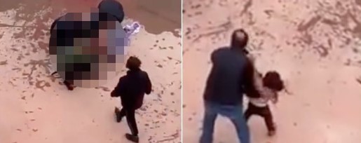 Gaziantep'te pitbull saldırısına uğrayan Asiye ağır yaralandı! Görüntüler ortaya çıktı