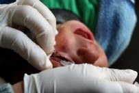 ŞARK ÇıBANı - Şark Çıbanı Salgını Nedir? Şark Çıbanı Bulaşıcı Mıdır?