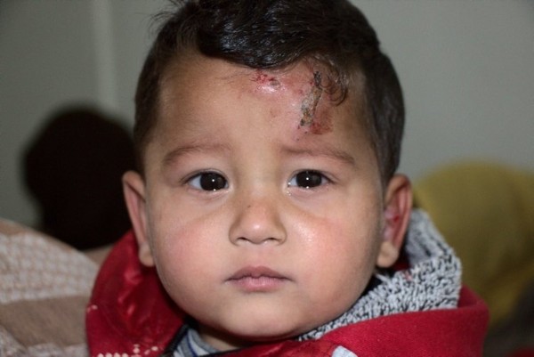 Şark Çıbanı Salgını Nedir? Şark Çıbanı Bulaşıcı Mıdır?