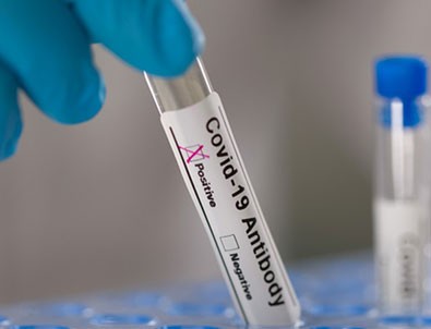 AB'den 'antikor kokteyli' adımı!