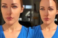 ALMANYA - Meryem Uzerli aşı için Türkiye'ye geliyor