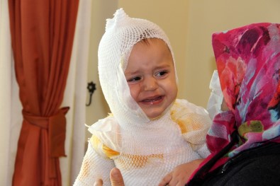 Erzincan'da Üzerine Kaynar Süt Dökülen Çocuk Hastanelik Oldu