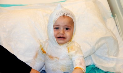 Üzerine Kaynar Süt Dökülen 1 Yaşındaki Çocuk Feci Şekilde Yandı