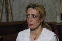 İranlı Mimar Kadın Eşinden Öldüresiye Dayak Yedi Haberi