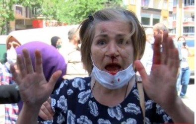 İstanbul'da Ekrem İmamoğlu'na 'parkımızı vermiyoruz' protestosu! Aracının kapısıyla vurduğu kadında kırıklar var