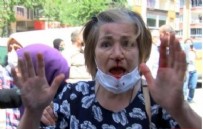İstanbul'da Ekrem İmamoğlu'na 'parkımızı vermiyoruz' protestosu! Aracının kapısıyla vurduğu kadında kırıklar var