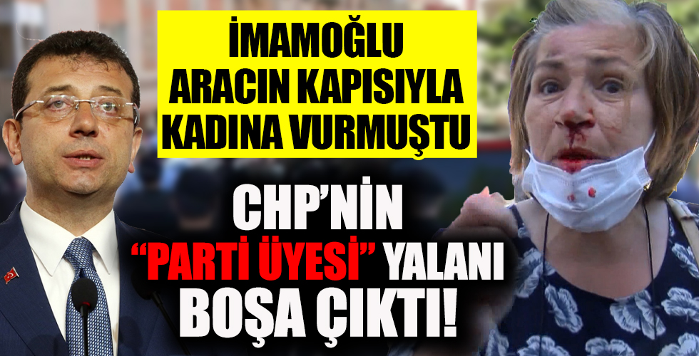 İstanbul'da Ekrem İmamoğlu'na 'parkımızı vermiyoruz' protestosu! Aracının kapısıyla vurduğu kadında kırıklar var