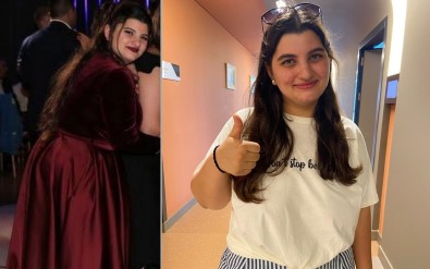 Obezite Ameliyati Olmaya Almanya'dan Geldi, 10 Günde 10 Kilo Verdi