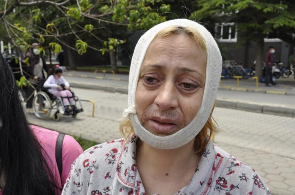 Eskişehir’de hayvanları beslerken darbedildi: Çenemde kırık var, platin takıldı