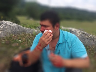 Feci Sekilde Darp Edilen IHA Muhabiri Uslu Açiklamasi 'Yere Yattim Fakat Tekmelemeye Devam Ettiler'