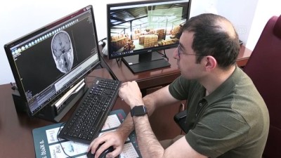 Zonguldak'ta Kulak Kemiginde Tümör Bulunan Hasta 11 Saatlik Operasyonla Sagligina Kavustu