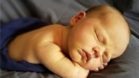  SARILIK TEDAVİSİ - Bebeklerde Sarılık Nasıl Geçer?  Sarılık Belirtileri