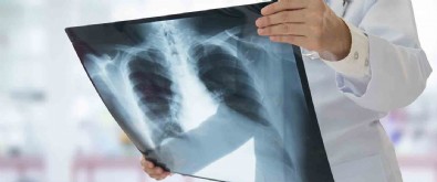 Pnömoni Nedir? Belirtileri Nelerdir?