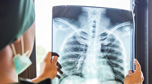 Zattüreden Korunma Yolları Nelerdir? Pnömoni Nedir? Belirtileri Nelerdir?