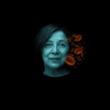 İNOVASYON - Diyabetik Yara Iyilesmesi Çalistayi'nda Üniversite-Sanayi Is Birliklerine Dikkat Çekildi