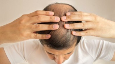 Koronavirüs Yüzünden Dökülen Saçlar Ne Zaman Çıkar?  Koronavirüs Sonrası Dökülen Saçlara Ne İyi Gelir?