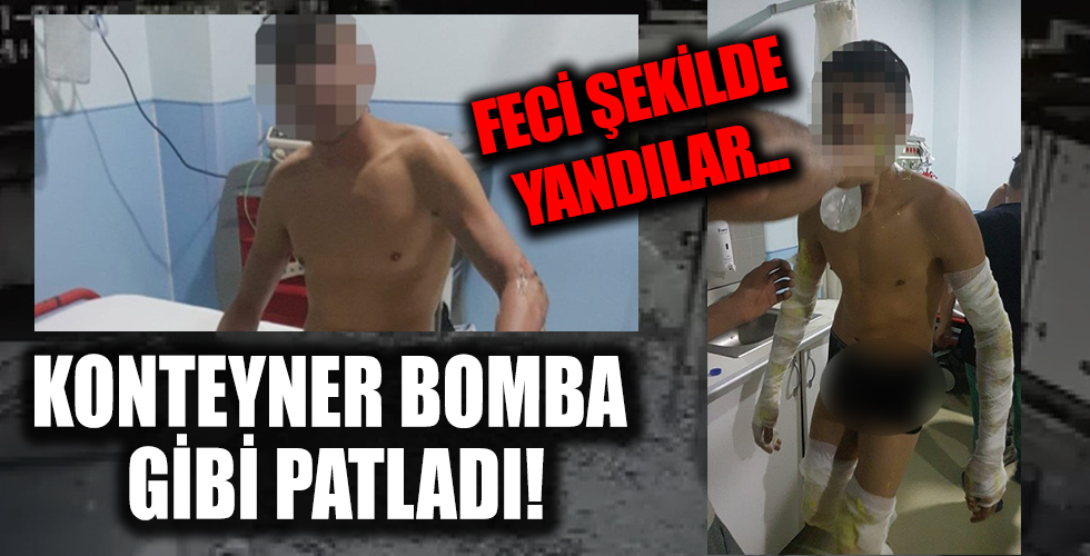 Korku filmi sahnesi gibi! Bir anda böyle patladı...