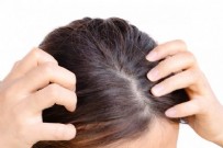 Saç Yağlanması Nasıl Önlenir? Saç Yağlanması Nasıl Geçer? Haberi
