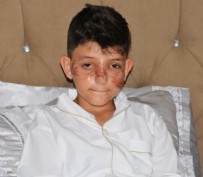 Bahşiş terörü! Sünnet çocuğu ölümden döndü: 'Aynaya bakınca kendimi tanıyamıyorum'