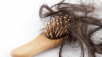 SAÇ DÖKÜLMESI - Saç Dökülmesi Neden Olur? Saç Dökülmesine Ne İyi Gelir?