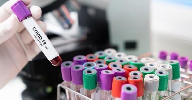 BM Genel Kurulu'na Katilan Brezilya Saglik Bakani'nin Korona Testi Pozitif Çikti