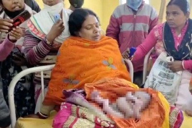 Dört kollu ve dört bacaklı doğdu! Görenler inanamadı!