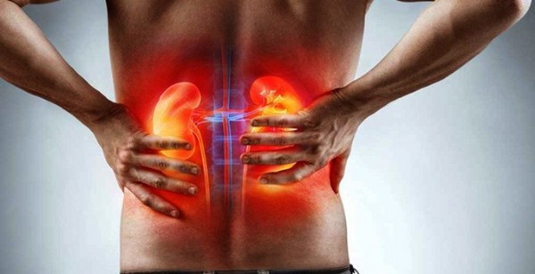 Böbrek Ağrısı Neden Olur? Böbrek Ağrısı Belirtileri Nelerdir?